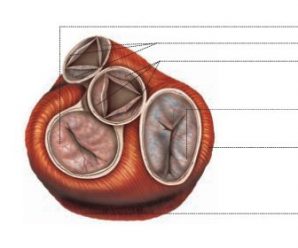 valvola mitrale chirurgia