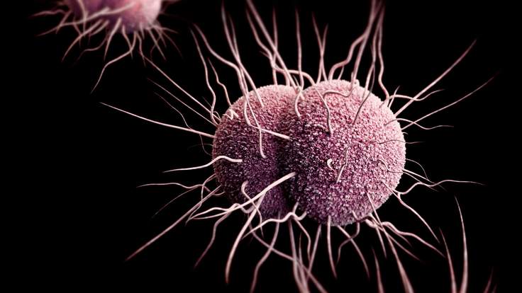Gonorrea: OMS lancia allarme infezioni genitali